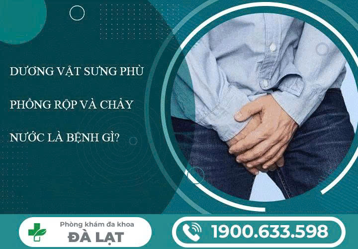 Hình ảnh minh họa